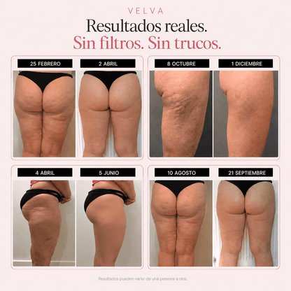 Leggings VELVA – Reafirma tu silueta y alisa tu piel sin esfuerzo